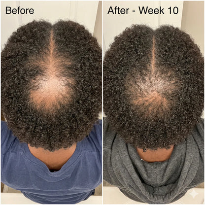 Firmelle Hair Restore